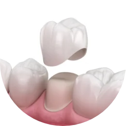 dental crowns